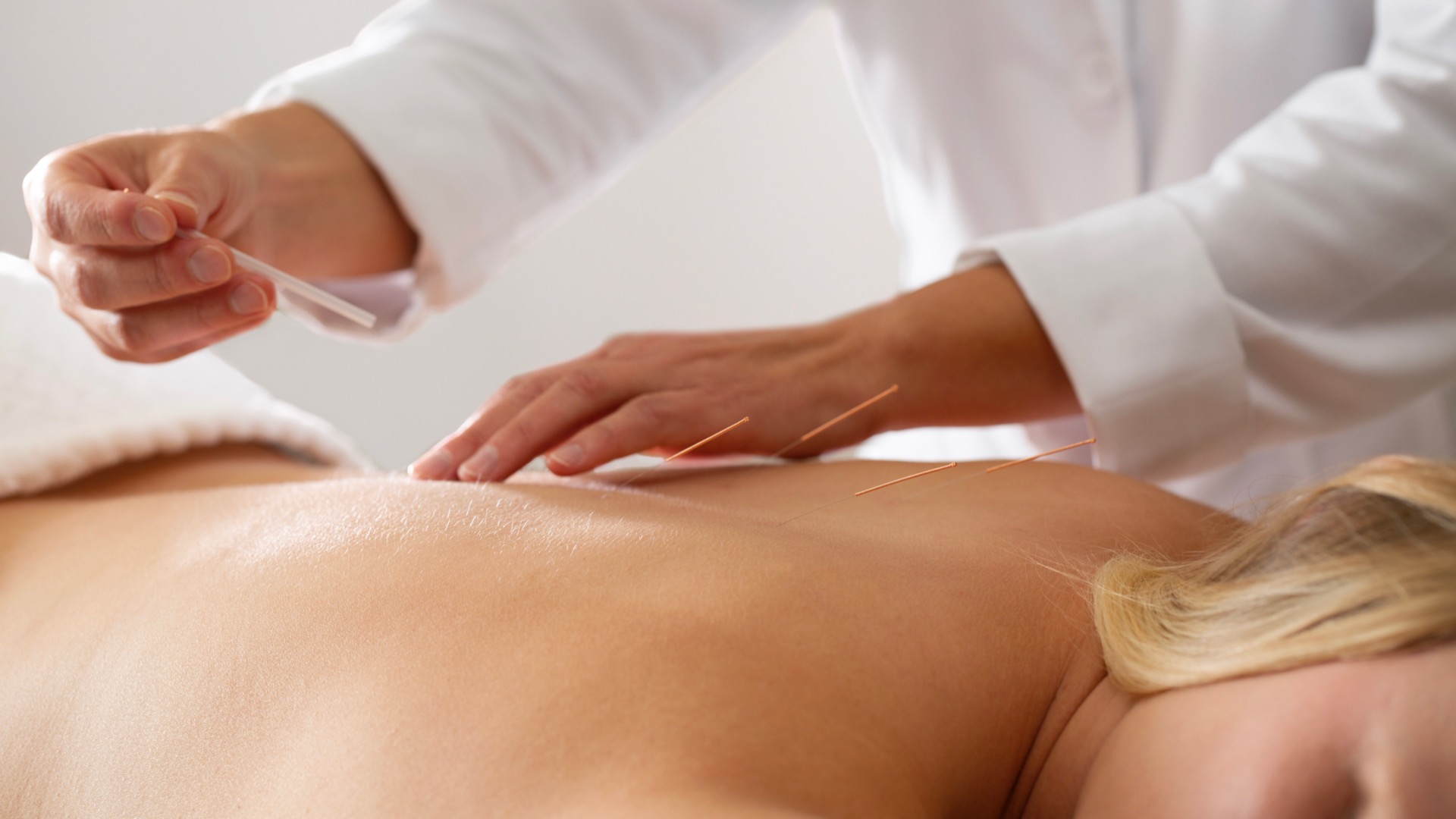 Acupuncture, Strata Integrated Wellness & Spa, Garden of the Gods Resort, Spas of America